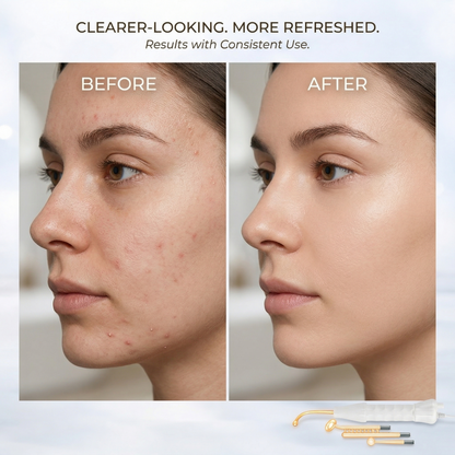 Aura ClearWave Pro High Frequency Facial Wand Aura Beauty Devices