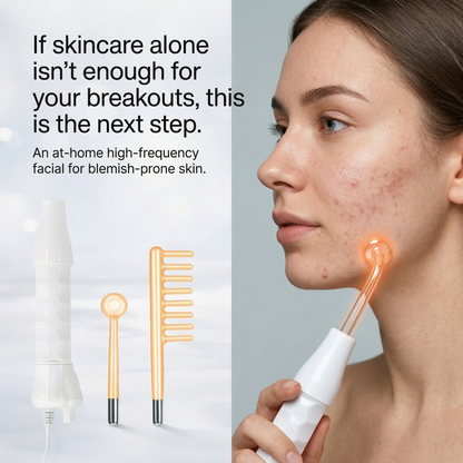 Aura ClearWave Pro — High Frequency Facial Wand for Blemish-Prone, Tired-Looking Skin Aura Beauty Devices